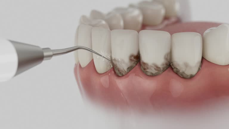 Trusted Dental Implants service in Scottsburg, IN - Dentist Open Now